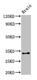 Western Blot Positive WB detected in: Mouse brain tissue All lanes: Cd74 antibody at 3µg/ml Secondary Goat polyclonal to rabbit IgG at 1/50000 dilution Predicted band size: 32, 25 kDa Observed band size: 32 kDa