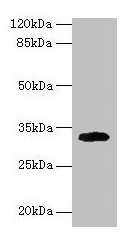 Western blot All lanes: Cd74 antibody at 2µg/ml + Mouse lung tissue Secondary Goat polyclonal to rabbit IgG at 1/10000 dilution Predicted band size: 32, 25 kDa Observed band size: 32 kDa