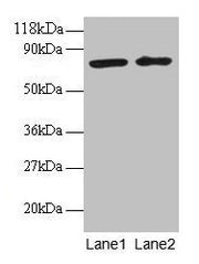 Western blot All lanes: BLOC1S1 antibody at 2µg/ml Lane 1: EC109 whole cell lysate Lane 2: 293T whole cell lysate Secondary Goat polyclonal to rabbit IgG at 1/15000 dilution Predicted band size: 18, 15 kDa Observed band size: 75 kDa