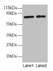 Western blot All lanes: BLOC1S1 antibody at 2µg/ml Lane 1: EC109 whole cell lysate Lane 2: 293T whole cell lysate Secondary Goat polyclonal to rabbit IgG at 1/15000 dilution Predicted band size: 18, 15 kDa Observed band size: 75 kDa