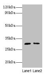 Western blot All lanes: Cd82 antibody at 2µg/ml Lane 1: Jurkat whole cell lysate Lane 2: A549 whole cell lysate Secondary Goat polyclonal to rabbit IgG at 1/10000 dilution Predicted band size: 30 kDa Observed band size: 30 kDa