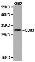 Western blot analysis of extracts of K562 cell lines, usingD83 antibody.