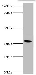 Western blot All lanes: SLAM family member 5 antibody at 6ug/ml + Mouse liver tissue Secondary Goat polyclonal to rabbit IgG at 1/10000 dilution Predicted band size: 39, 37, 32, 31, 27, 25 kDa Observed band size: 39 kDa