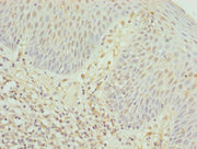 Immunohistochemistry of paraffin-embedded human tonsil tissue using CSB-PA004966LA01HU at dilution of 1:100