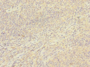 Immunohistochemistry of paraffin-embedded human tonsil tissue using CSB-PA004967ESR1HU at dilution of 1:100