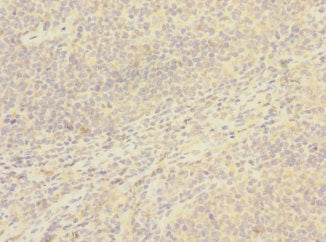 Immunohistochemistry of paraffin-embedded human tonsil tissue using CSB-PA004967ESR1HU at dilution of 1:100