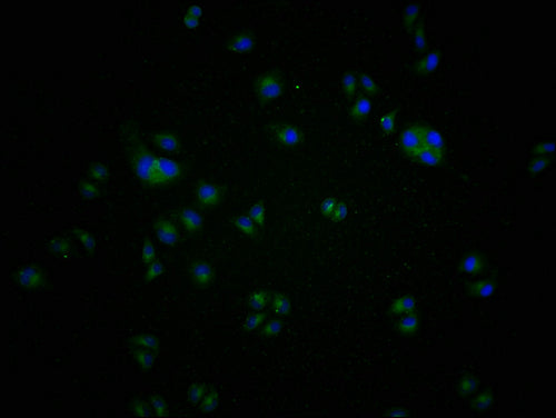 Immunofluorescence staining of A549 cells with CSB-PA004969LA11HU at 1:100, counter-stained with DAPI. The cells were blocked in 10% normal Goat Serum and incubated with the antibody overnight at 4°C. The secondary antibody was Alexa Fluor 488-con...