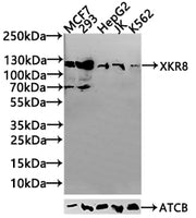 Western Blot Positive WB detected in: MCF7 whole cell lysate(20µg), 293 whole cell lysate(20µg), JK whole cell lysate(20µg), K562 whole cell lysate(20µg), Hela whole cell lysate(20µg) All lanes: CD96 antibody at 1:1000 Secondary Goat polyclonal to...