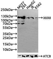Western Blot Positive WB detected in: MCF7 whole cell lysate(20µg), 293 whole cell lysate(20µg), JK whole cell lysate(20µg), K562 whole cell lysate(20µg), Hela whole cell lysate(20µg) All lanes: CD96 antibody at 1:1000 Secondary Goat polyclonal to...