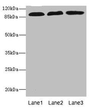 Western blot All lanes: CD97 antibody at 3.11ug/ml Lane 1: HL60 whole cell lysate Lane 2: HepG2 whole cell lysate Lane 3: Jurkat whole cell lysate Secondary Goat polyclonal to rabbit IgG at 1/10000 dilution Predicted band size: 92, 82, 87 kDa Obse...