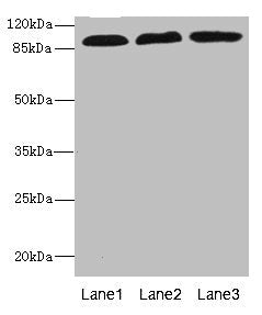 Western blot All lanes: CD97 antibody at 3.11ug/ml Lane 1: HL60 whole cell lysate Lane 2: HepG2 whole cell lysate Lane 3: Jurkat whole cell lysate Secondary Goat polyclonal to rabbit IgG at 1/10000 dilution Predicted band size: 92, 82, 87 kDa Obse...