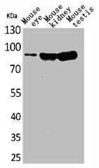 Western Blot analysis of mouse eye mouse kidney mouse testis cells using Hrs Polyclonal Antibody