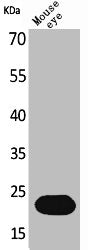 Western Blot analysis of mouse eye cells using BNIP-3 Polyclonal Antibody