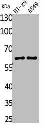 Western Blot analysis of HT29 A549 cells using Catalase Polyclonal Antibody