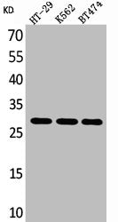 Western Blot analysis of HT29 K562 BT474 cells using BRMS-1 Polyclonal Antibody