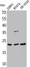 Western Blot analysis of 22RV-1 BT474 SHSY5Y cells using FGF-12 Polyclonal Antibody