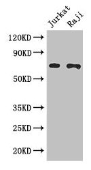 Western Blot Positive WB detected in: Jurkat whole cell lysate, Raji whole cell lysate All lanes: CDC25B antibody at 3µg/ml Secondary Goat polyclonal to rabbit IgG at 1/50000 dilution Predicted band size: 65, 64, 61, 68 kDa Observed band size: 65 kDa