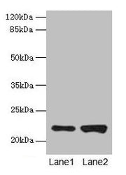 Western blot All lanes: CDC42 antibody at 6µg/ml Lane 1: Hela whole cell lysate Lane 2: Jurkat whole cell lysate Secondary Goat polyclonal to rabbit IgG at 1/10000 dilution Predicted band size: 22 kDa Observed band size: 22 kDa