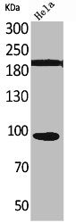 Western Blot analysis of HeLa cells using Trk C Polyclonal Antibody
