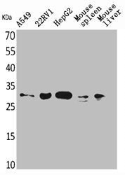 Western Blot analysis of A549 22RV-1 HepG2 mouse spleen mouse liver cells using TALL-1 Polyclonal Antibody