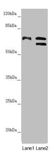 Western blot All lanes: CDC45 antibody at 1.05µg/ml Lane 1: K562 whole cell lysate Lane 2: 293T whole cell lysate Secondary Goat polyclonal to rabbit IgG at 1/10000 dilution Predicted band size: 66, 61, 69 kDa Observed band size: 66, 69 kDa