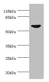 Western blot All lanes: CDC7 antibody at 0.95ug/ml + SY-5Y whole cell lysate Secondary Goat polyclonal to rabbit IgG at 1/10000 dilution Predicted band size: 64 kDa Observed band size: 64 kDa