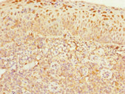 Immunohistochemistry of paraffin-embedded human tonsil tissue using CSB-PA005023ESR2HU at dilution of 1:100
