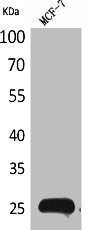 Western Blot analysis of MCF7 cells using CBP 35 Polyclonal Antibody