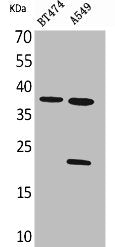 Western Blot analysis of BT474 A549 cells using IFN-α1 Polyclonal Antibody