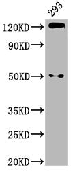 Western Blot Positive WB detected in: 293 whole cell lysate All lanes: CDH1 antibody at 2.9µg/ml Secondary Goat polyclonal to rabbit IgG at 1/50000 dilution Predicted band size: 98, 91 kDa Observed band size: 125 kDa