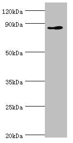 Western blot All lanes: CDH11 antibody at 6ug/ml + Jurkat whole cell lysate Secondary Goat polyclonal to rabbit IgG at 1/10000 dilution Predicted band size: 88, 77 kDa Observed band size: 88 kDa
