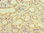 Immunohistochemistry of paraffin-embedded human kidney tissue using CSB-PA005036ESR2HU at dilution of 1:100