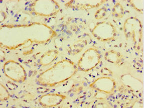 Immunohistochemistry of paraffin-embedded human kidney tissue using CSB-PA005036ESR2HU at dilution of 1:100