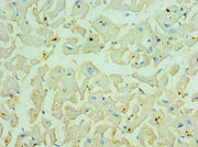 Immunohistochemistry of paraffin-embedded human heart tissue using CSB-PA005039ESR2HU at dilution of 1:100