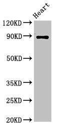 Western Blot Positive WB detected in: Rat heart tissue All lanes: CDH15 antibody at 3.2ug/ml Secondary Goat polyclonal to rabbit IgG at 1/50000 dilution Predicted band size: 89 kDa Observed band size: 89 kDa