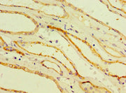Immunohistochemistry of paraffin-embedded human kidney tissue using CSB-PA005041ESR1HU at dilution of 1:100