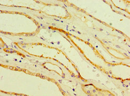 Immunohistochemistry of paraffin-embedded human kidney tissue using CSB-PA005041ESR1HU at dilution of 1:100