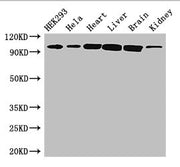 Western Blot Positive WB detected in: HEK293 whole cell lysate, Hela whole cell lysate, Mouse heart tissue, Mouse liver tissue, Mouse brain tissue, Mouse kidney tissue All lanes: CDH2 antibody at 3ug/ml Secondary Goat polyclonal to rabbit IgG at 1...