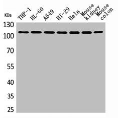 Western Blot analysis of THP-1 H460 A549 HT29 HeLa mouse kidney mouse colon cells using cPLA2 Polyclonal Antibody