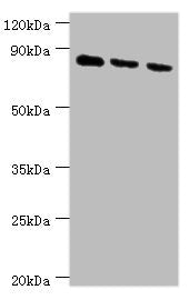 Western blot All lanes: CDH6 antibody at 6ug/ml Lane 1: 293T whole cell lysate Lane 2: Hela whole cell lysate Lane 3: A549 whole cell lysate Secondary Goat polyclonal to rabbit IgG at 1/10000 dilution Predicted band size: 89, 74 kDa Observed band...
