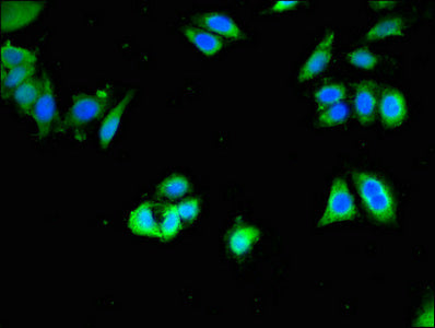 Immunofluorescent analysis of PC-3 cells using CSB-PA005057LA01HU at dilution of 1:100 and Alexa Fluor 488-congugated AffiniPure Goat Anti-Rabbit IgG(H+L)