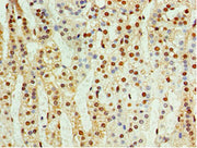Immunohistochemistry of paraffin-embedded human adrenal gland tissue using CSB-PA005060ESR2HU at dilution of 1:100