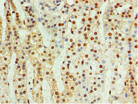 Immunohistochemistry of paraffin-embedded human adrenal gland tissue using CSB-PA005060ESR2HU at dilution of 1:100