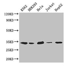 Western Blot Positive WB detected in: K562 whole cell lysate, HEK293 whole cell lysate, Hela whole cell lysate, Jurkat whole cell lysate, HepG2 whole cell lysate All lanes: CDK2 antibody at 2.6µg/ml Secondary Goat polyclonal to rabbit IgG at 1/500...
