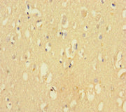 Immunohistochemistry of paraffin-embedded human brain tissue using CSB-PA005063LA01HU at dilution of 1:100