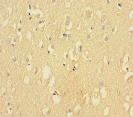 Immunohistochemistry of paraffin-embedded human brain tissue using CSB-PA005063LA01HU at dilution of 1:100