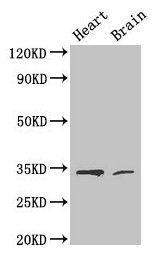 Western Blot Positive WB detected in: Mouse heart tissue, Mouse brain tissue All lanes: CDK5 antibody at 4µg/ml Secondary Goat polyclonal to rabbit IgG at 1/50000 dilution Predicted band size: 34, 30 kDa Observed band size: 34 kDa