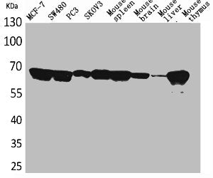 Western Blot analysis of MCF7 SW480 PC-3 SKOV3 mouse spleen mouse brain mouse liver mouse thymus cells using Lamin B1 Polyclonal Antibody