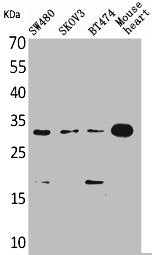 Western Blot analysis of SW480 SKOV3 BT474 mouse heart cells using FGF-18 Polyclonal Antibody