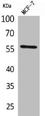 Western Blot analysis of MCF7 cells using ALK-1 Polyclonal Antibody